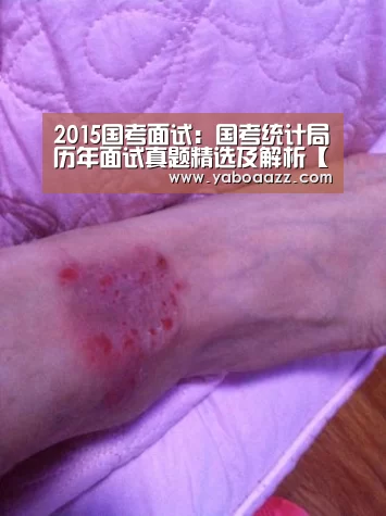 2015国考面试:国考统计局历年面试真题精选及解析【亚博体育】(图1) 亚博